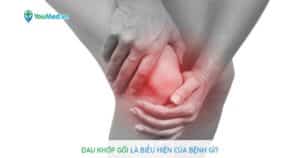 Đau khớp gối là biểu hiện của bệnh gì?