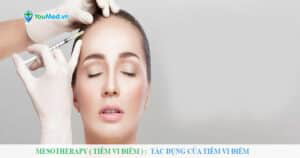 Mesotherapy (tiêm vi điểm): Tác dụng và rủi ro có thể gặp