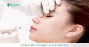 Tiêm filler: Những điều bạn cần phải biết