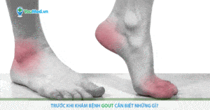 Trước khi khám bệnh Gout cần biết những gì?