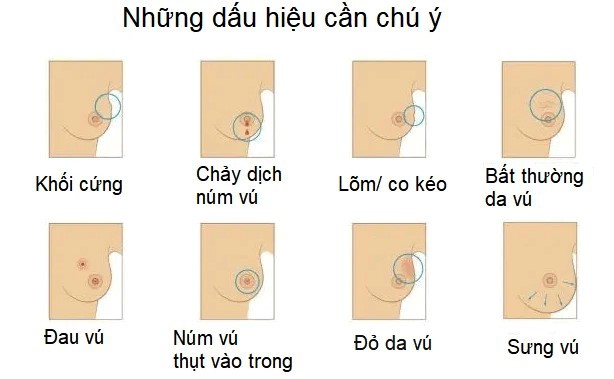 Những dấu hiệu bất thường cần chú ý khi tự khám vú