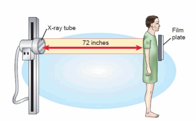 Những tư thế chụp Xquang thường gặp