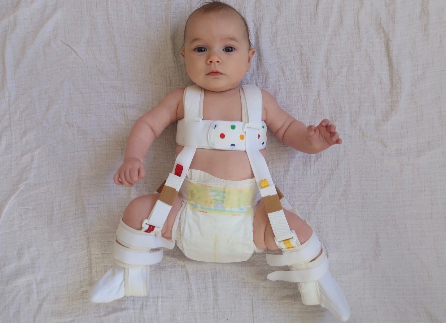 Nẹp Pavlik Harness giúp định hình lại khớp háng