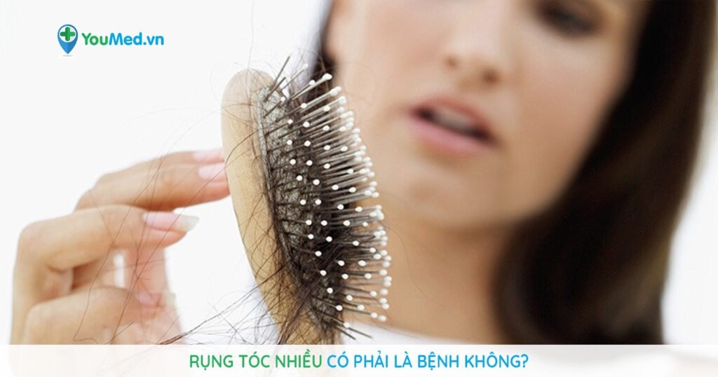 Rụng tóc nhiều có phải là bệnh không?