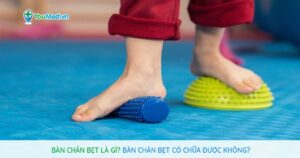 Bàn chân bẹt là gì? Bàn chân bẹt có chữa được không?