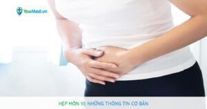 Hẹp môn vị : Những thông tin cơ bản