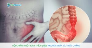 Hội chứng ruột kích thích (IBS): Nguyên nhân và triệu chứng
