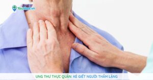 Ung thư thực quản: Kẻ giết người thầm lặng