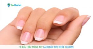 10 dấu hiệu móng tay bất thường cảnh báo sức khỏe