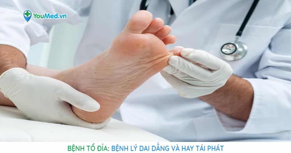 Bệnh tổ đỉa: Bệnh lý dai dẳng và hay tái phát