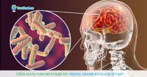 Viêm màng não do vi khuẩn: Phòng tránh bằng cách nào?