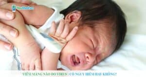 Viêm màng não do virus: Có nguy hiểm không?