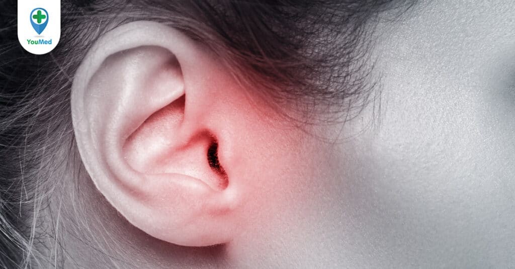 Viêm tai giữa ở trẻ em: nguyên nhân, triệu chứng và điều trị