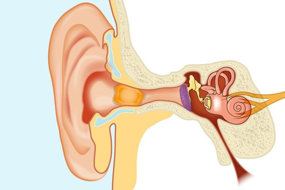 Tắc nghẽn ráy tai dẫn đến hình thành nút ráy tai