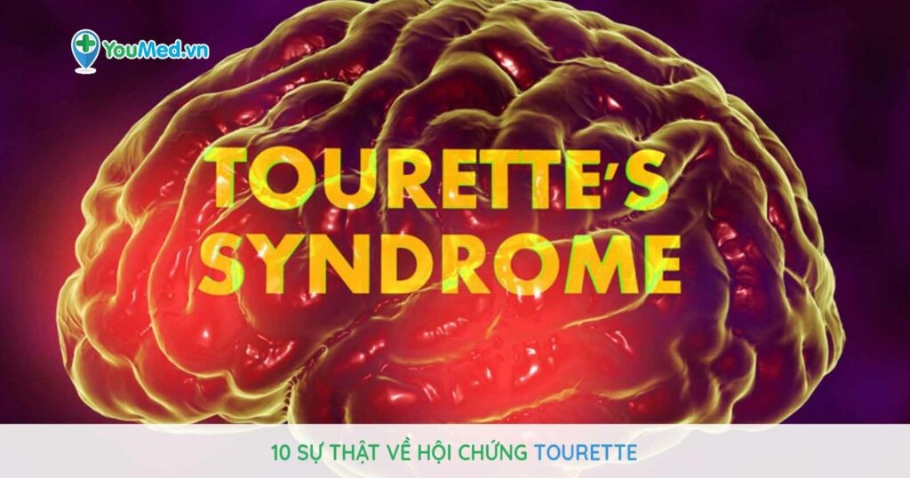 Hội chứng Tourette: 10 sự thật không thể bỏ qua