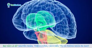 Bại não là gì? Nguyên nhân, triệu chứng, cách điều trị và phòng ngừa ra sao?