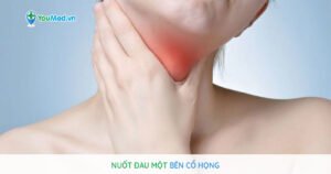 Nuốt đau một bên cổ họng nên làm gì?