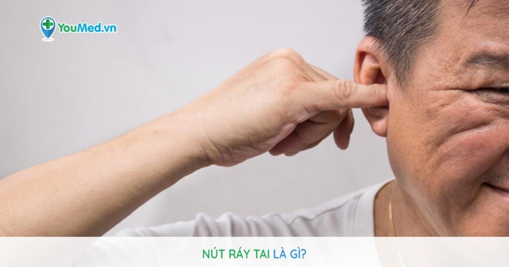 Nút ráy tai: Có thể gây ra những khó chịu gì?