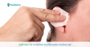 Chảy máu tai: Những nguyên nhân thường gặp