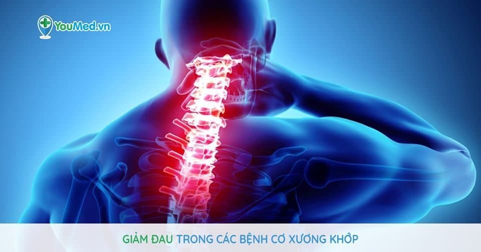 Giảm đau trong các bệnh cơ xương khớp