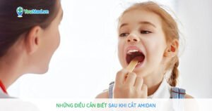 Những điều cần biết sau khi cắt amiđan