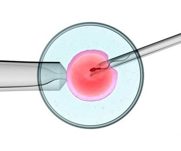 Tiêm tinh trùng vào trứng trong hỗ trợ sinh sản