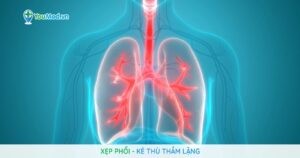 Xẹp phổi: nguyên nhân, triệu chứng và cách điều trị