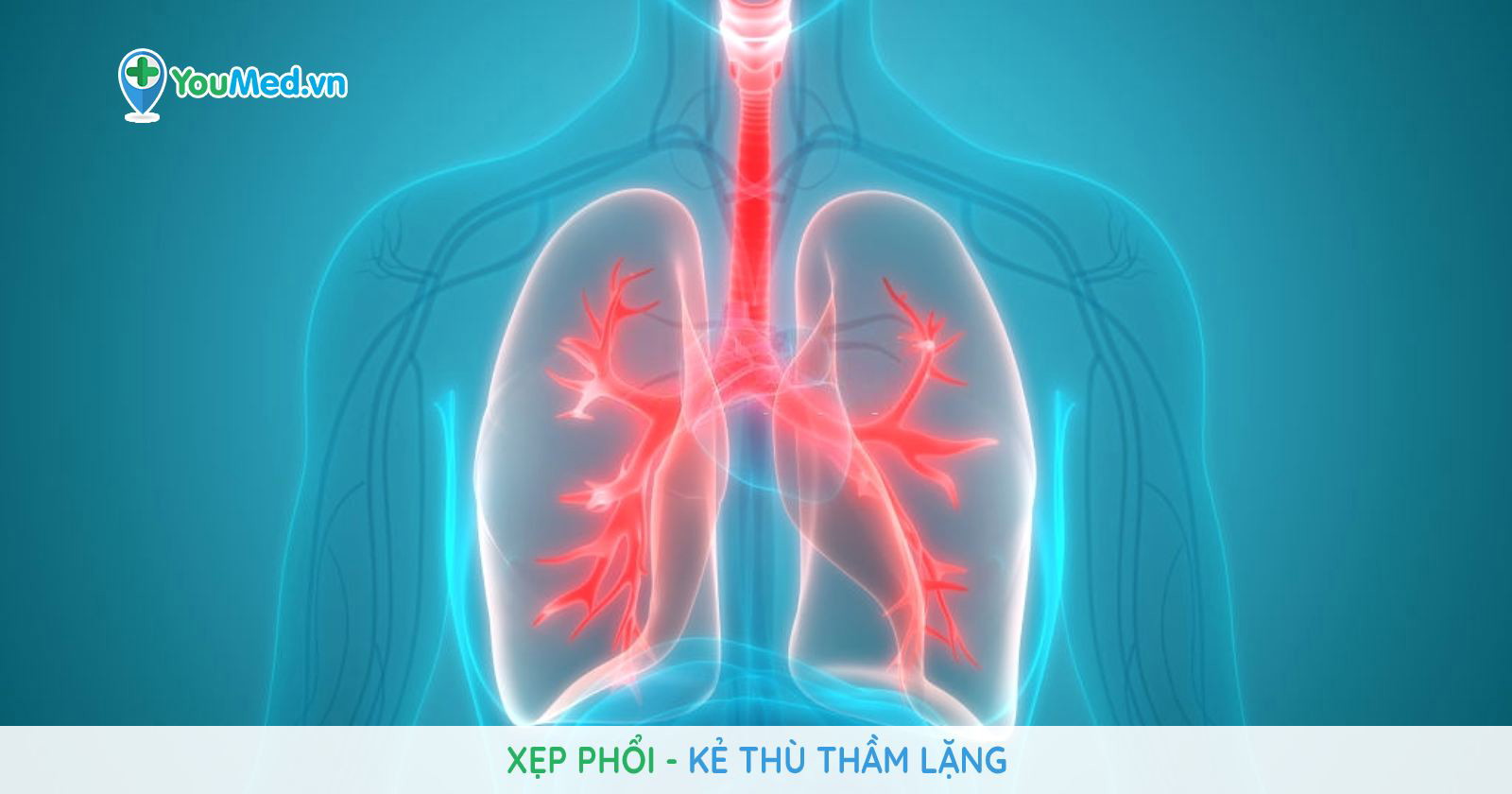 Xẹp phổi có thể gây viêm phổi không?
