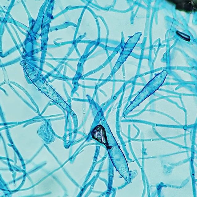 nấm dermatophytes