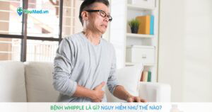 Bệnh Whipple là gì? Nguy hiểm như thế nào?