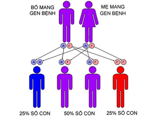 Bệnh teo cơ tủy sống là do di truyền