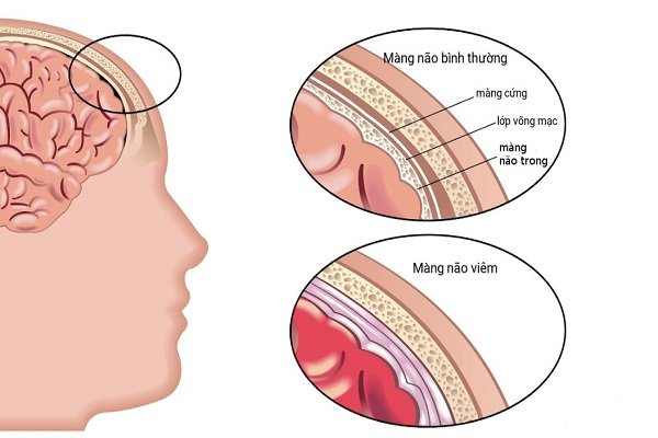 7. Lời Khuyên Dành Cho Người Bệnh