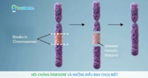 Hội chứng DiGeorge và những điều bạn chưa biết