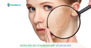 Những điều bác sĩ muốn bạn biết về làn da khô