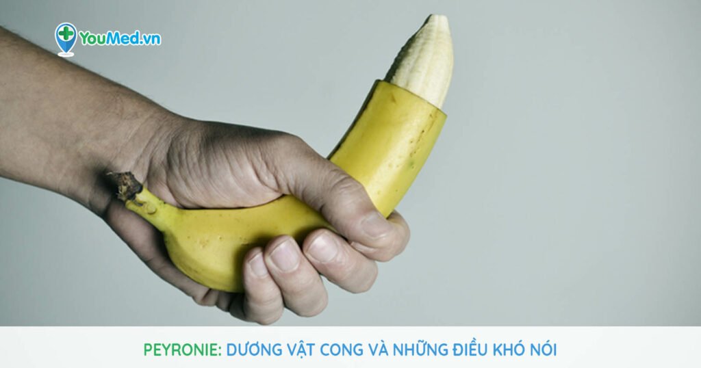 Người bệnh Peyronie cần làm gì để hạn chế bị bệnh?