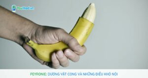 Người bệnh Peyronie cần làm gì để hạn chế bị bệnh?