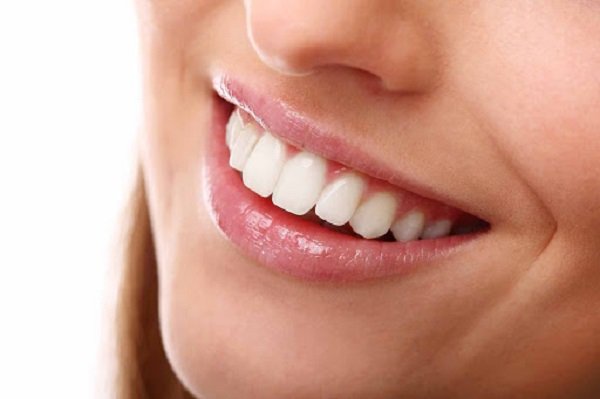 Veneer sứ là gì? Có cần mài răng không? - YouMed