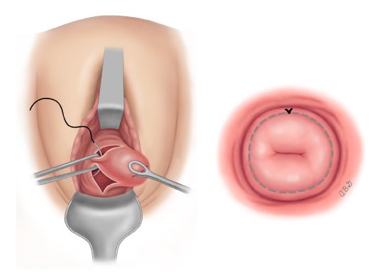 5. Những rủi ro có thể gặp phải