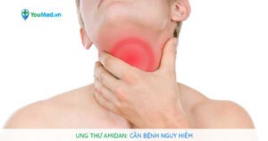 Hình ảnh dấu hiệu nhận biết ung thư amidan