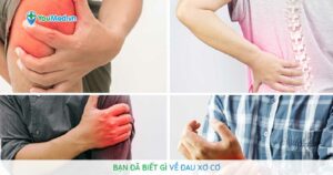 Bạn đã biết gì về đau xơ cơ?