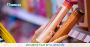 Dầu gội cho người bị vảy nến da đầu