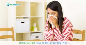 Những điều cần biết về dị ứng nấm mốc