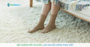 Gãy xương mắt cá chân: Làm sao để chóng phục hồi?