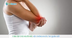 5 bài tập dành cho người bị hội chứng khuỷu tay quần vợt