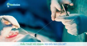 Phẫu thuật mũi xoang: Mọi điều bạn cần biết