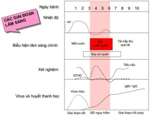 sốt xuất huyết