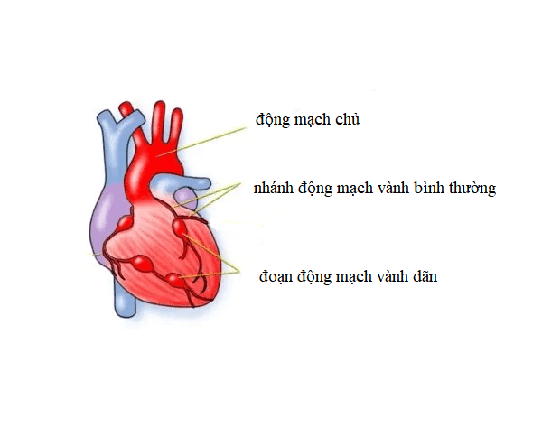 động mạch vành