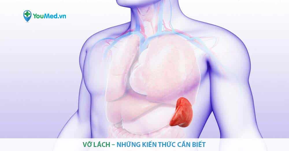 Vỡ lách – những kiến thức cần biết