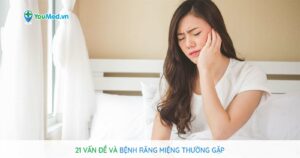 21 vấn đề về bệnh răng miệng thường gặp