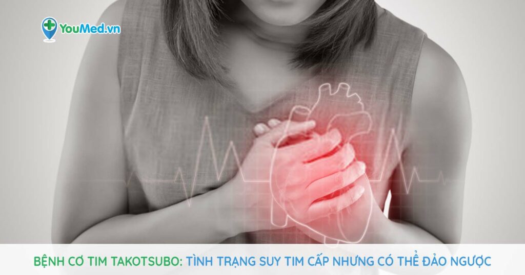 Bệnh cơ tim Takotsubo: Tình trạng suy tim cấp có thể đảo ngược!